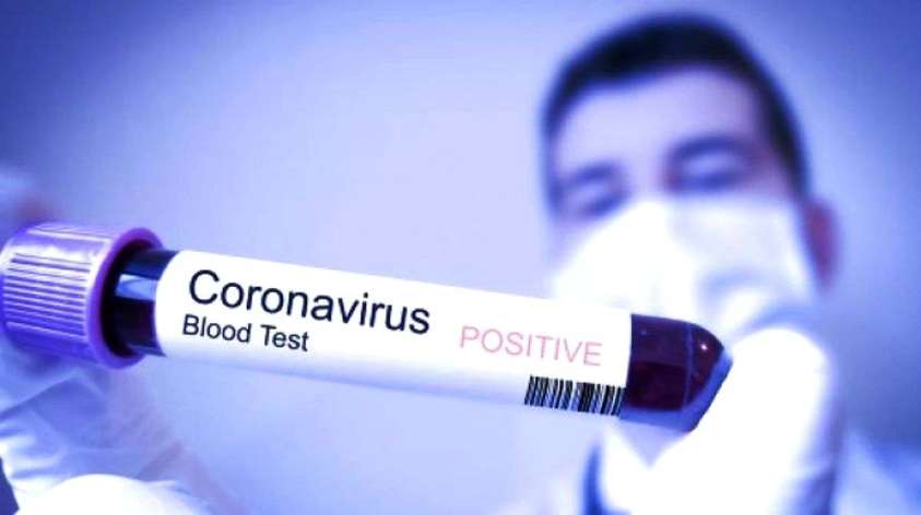 Virus Corona