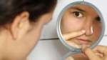 Oh ini, Penyebab Jerawat Muncul di Hidung