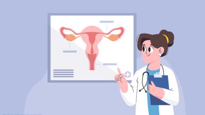 Kanker serviks dengan pap smear