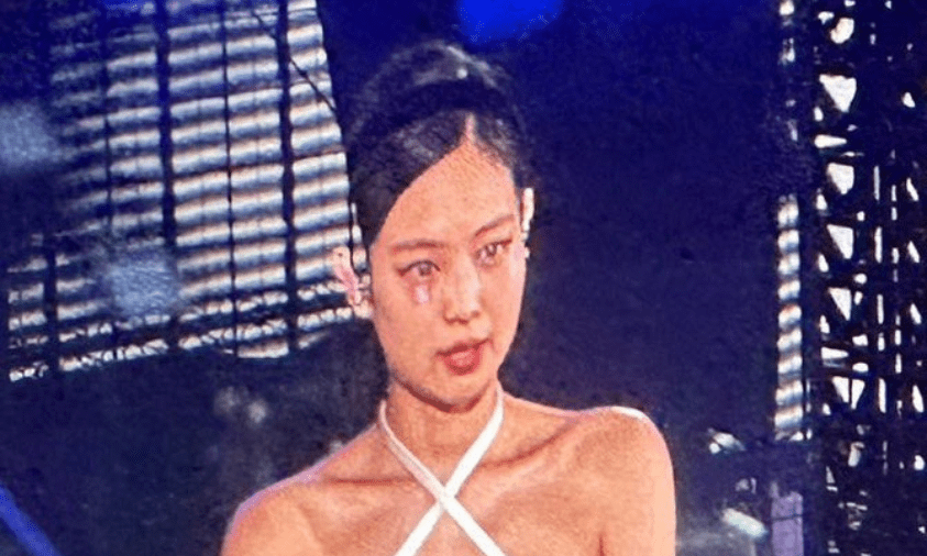 wajah jennie terluka dipakaikan plester