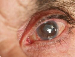 Operasi Katarak: Mengembalikan Kualitas Penglihatan