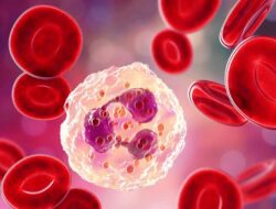 Tanda Kolesterol pada Tubuh dan 7 Cara Menjaganya Agar Stabil!