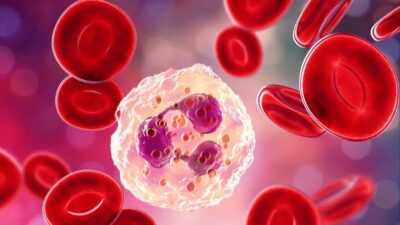 Tanda Kolesterol Pada Tubuh