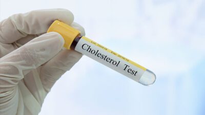 Kadar kolesterol