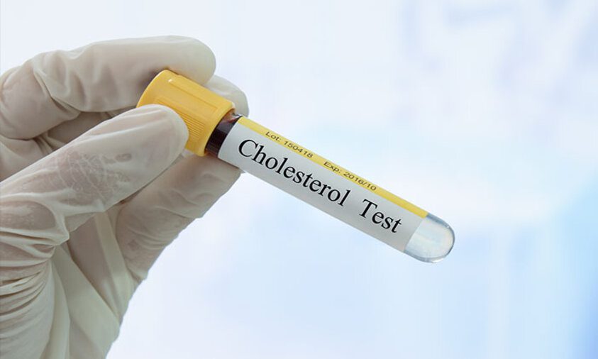 Kadar kolesterol