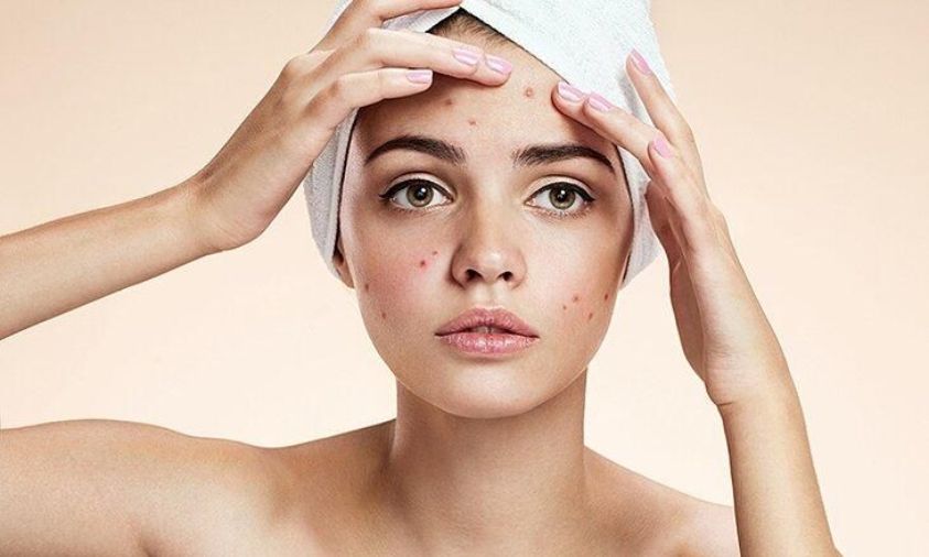 purging dan breakout