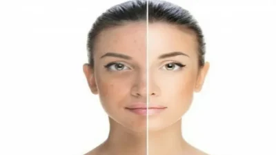 Anti Penuaan! Ini Cara Merawat Kulit di Usia Menjelang 30 Tahun