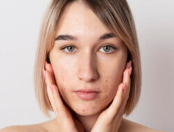 Hati-Hati! Ini Kebiasaan Skincare yang Justru Merusak Kulit