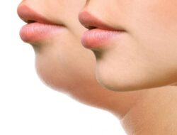 Cara Alami Menghilangkan Double Chin dengan Metode Alami, Bye-Bye Dagu Berlipat!