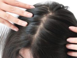 Tips Merawat Kulit Kepala dan Akar Rambut agar Tidak Rapuh