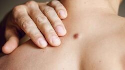 Makanan dan Kebiasaan Sehat yang Bantu Cegah Kista sejak Dini